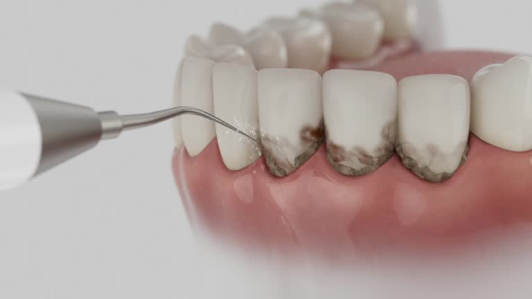 Trusted Tooth Extraction service in Windber, PA - Dentist Open Now